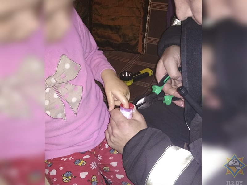 Минские спасатели освободили палец 5-летней девочки из игрушки