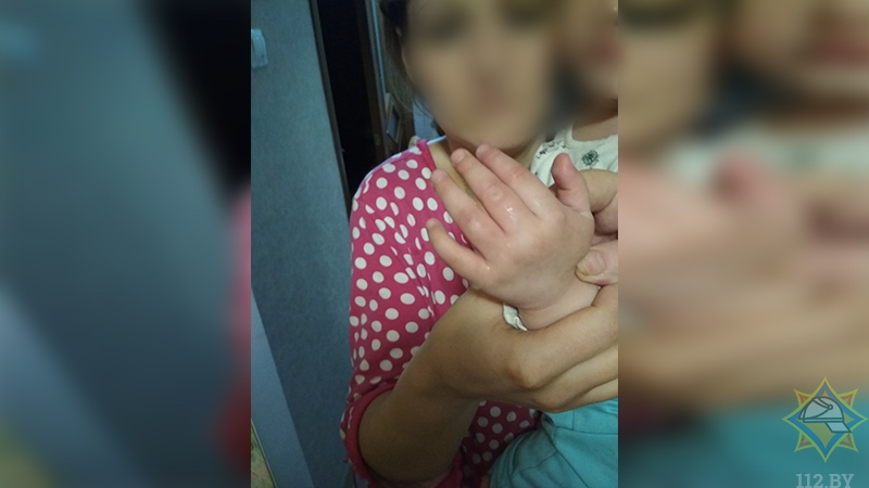 Спасатели ломом доставали пальцы двухлетней девочки из дверного проема